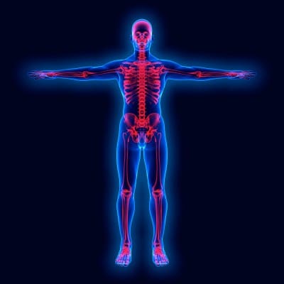 osteoporosis